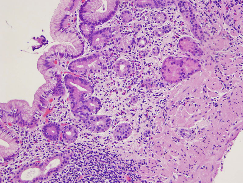 Pathology Image